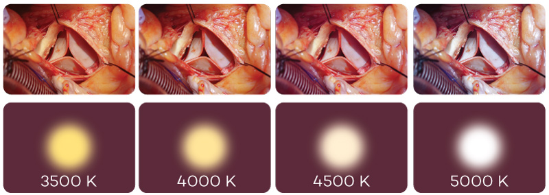 Adjustable Color Temperature feature in Komax OT Light